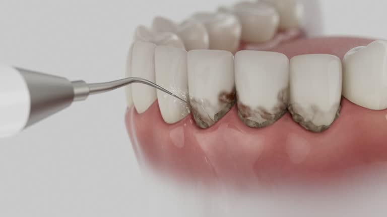 Reliable Dental contractor in Versailles, MO by Dentist Open Now
